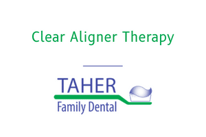Clear Aligner Therapy - West Boylston Mass - Taher Family Dental