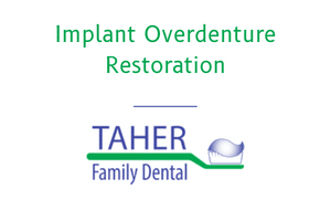 Implant Overdenture Restoration - West Boylston MA - Taher Family Dental