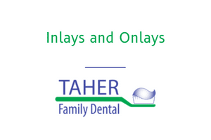 Inlays and Onlays - West Boylston Dentist - Taher Family Dental