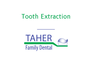 Tooth Extraction - West Boylston Mass - Taher Family Dental
