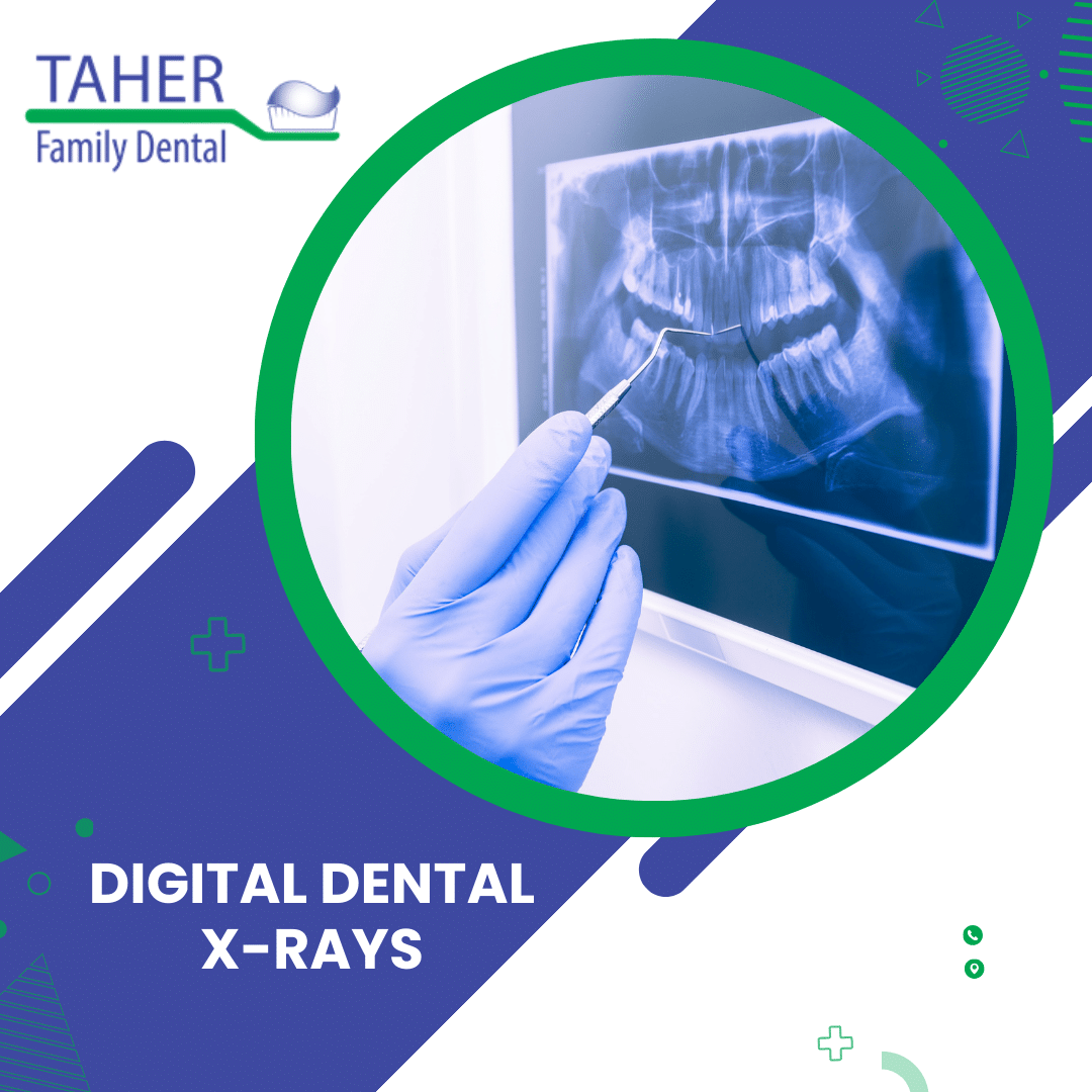 Taher Family Dental - Digital Dental X-rays - Worcester Dentist